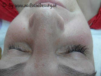 Linkes Auge: vorher, Rechtes Auge: Nachher