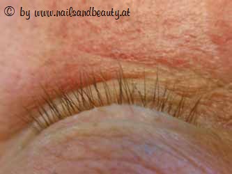 Schlupflieder Vorher