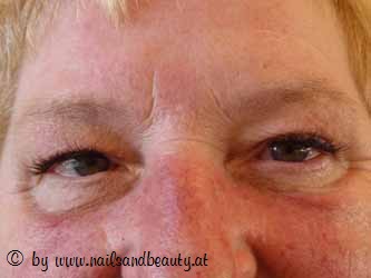 Schlupflieder Nachher